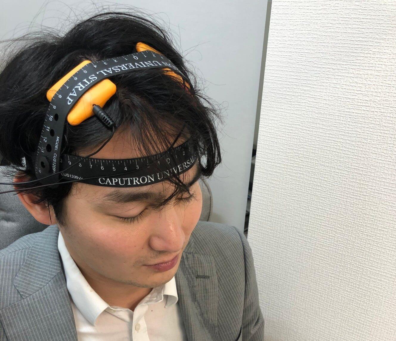 精神科専門医が解説】tDCS、2024年最新の知見。TMSとの違いは 精神科専門医が解説】tDCS、2024年最新の知見。TMSとの違いは