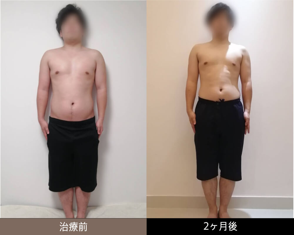 痩身外来 新宿区の心療内科 精神科 夜間中心 ライトメンタルクリニック高田馬場院