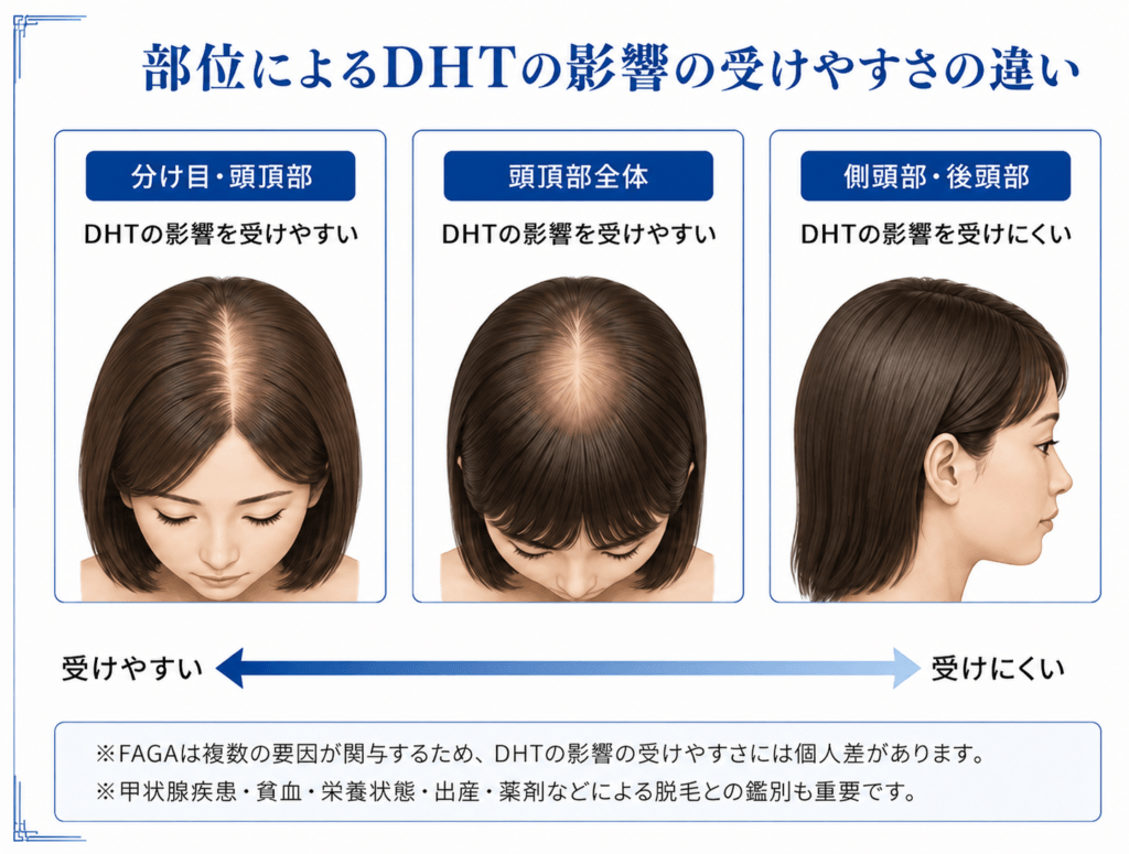 FAGA部位によるDHTの影響の受けやすさの違い