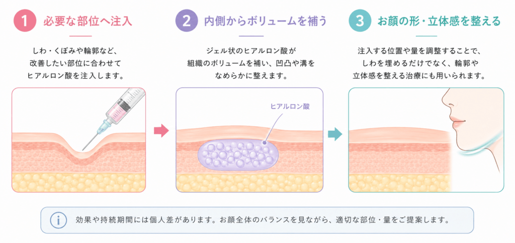 ヒアルロン酸注射 1ml 8,600円〜|渋谷でしわ・ほうれい線治療 3 ヒアルロン酸注射 仕組み
