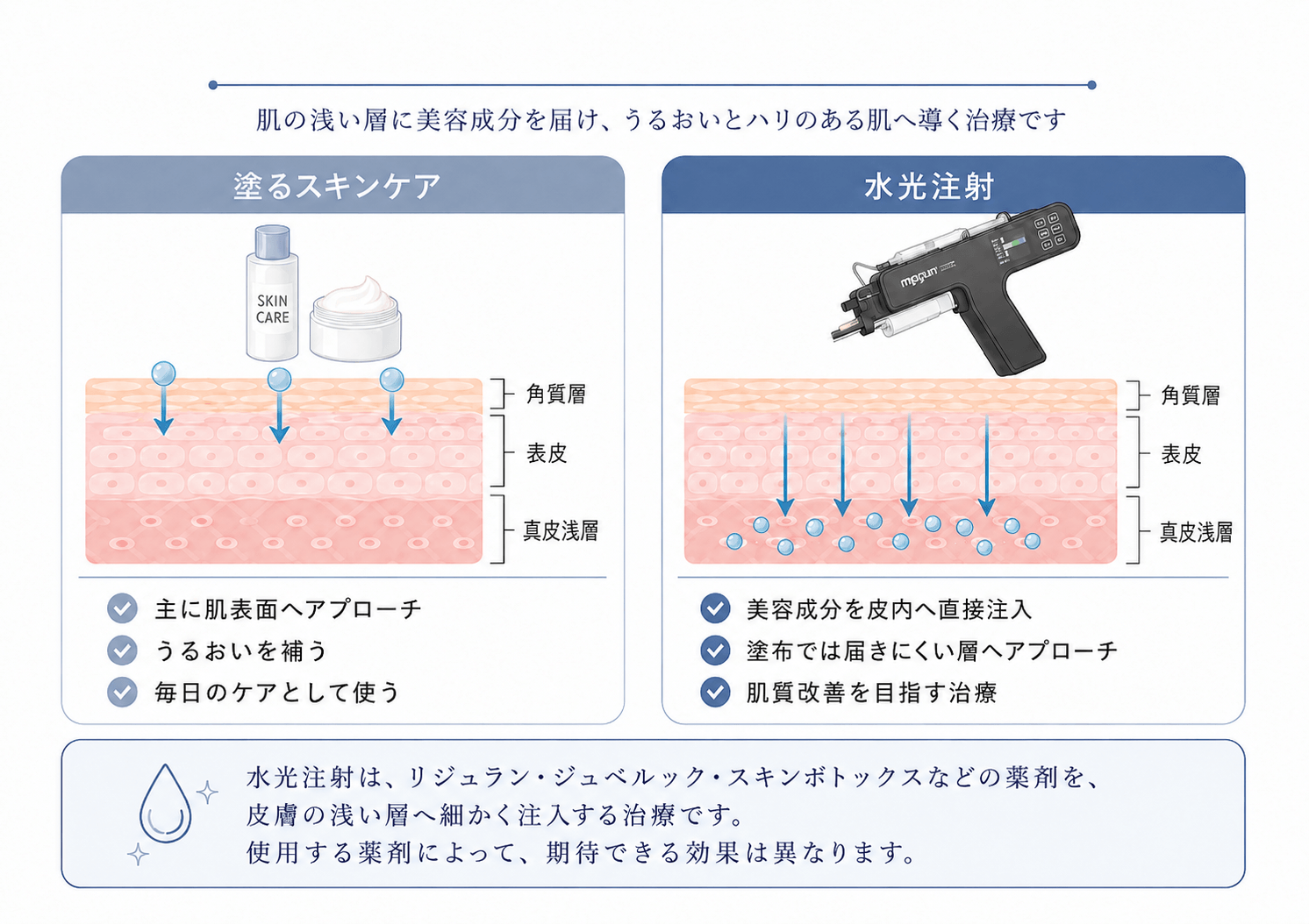 水光注射　違い