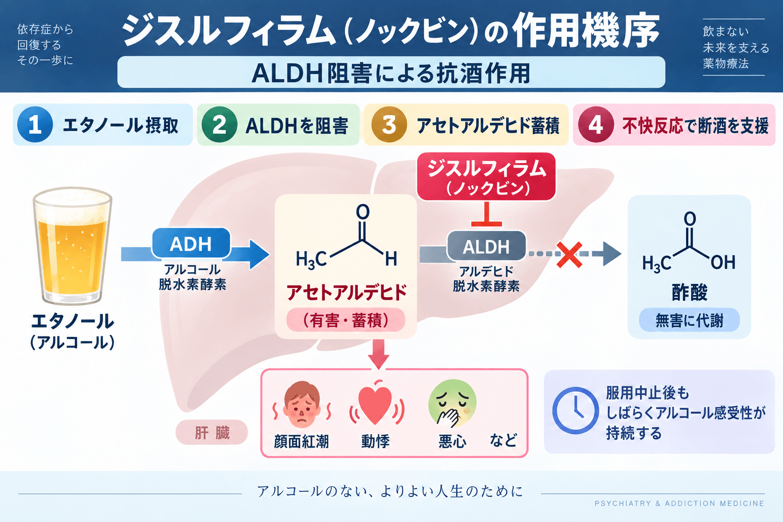 ジスルフィラム（ノックビン）の作用機序｜ALDH阻害とアセトアルデヒド蓄積