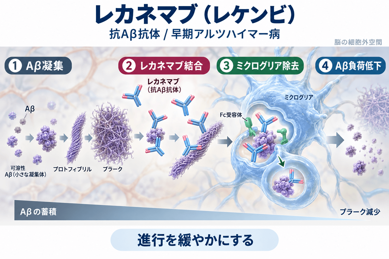 レカネマブ（レケンビ）の作用機序。Aβプロトフィブリルへの結合とミクログリアによる除去